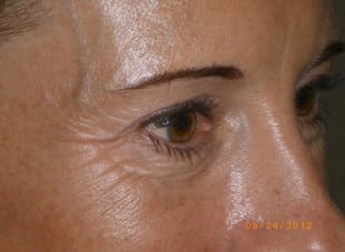 Patient 117 - Before View 