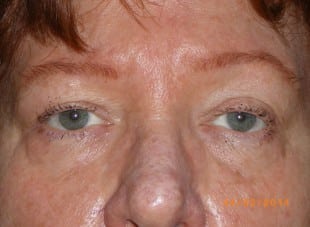 Patient 145 - Before View 