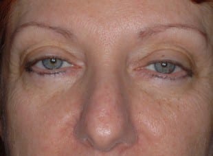 Patient 147 - Before View 