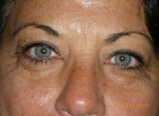 Patient 149 - Before View 