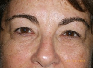 Patient 157 - Before View 