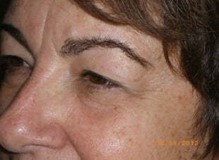 Patient 157 - Before View 