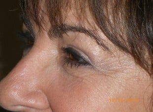 Patient 157 - After View 