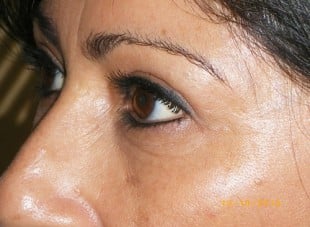 Patient 159 - After View 