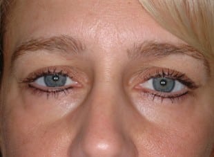 Patient 167 - After View 