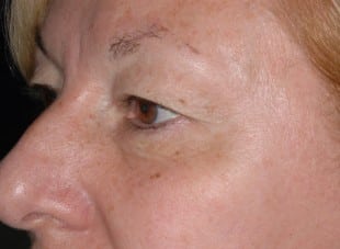 Patient 169 - Before View 