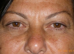 Patient 173 - Before View 