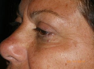 Patient 173 - After View 