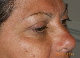 Patient 173 - After View 