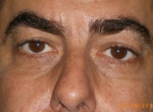 Patient 54 - After View 