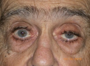 Patient 66 - Before View 