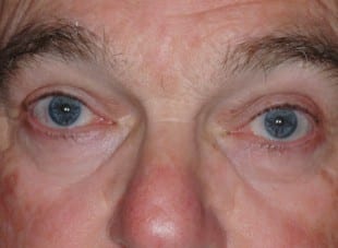 Patient 73 - After View 