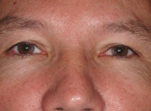Patient 76 - Before View 