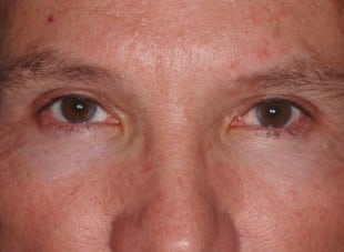 Patient 76 - After View 