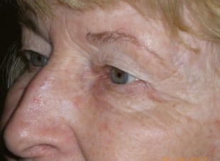 Patient 70 - Before View 