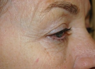Patient 113 - Before View 