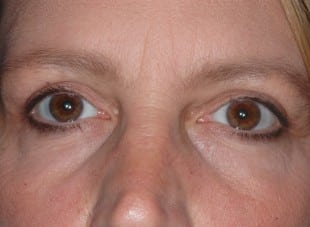 Patient 118 - After View 