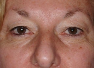 Patient 119 - Before View 