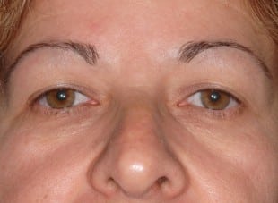 Patient 123 - Before View 