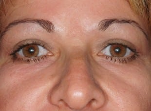 Patient 123 - After View 