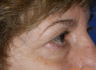 Patient 125 - Before View 