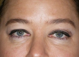 Patient 131 - Before View 