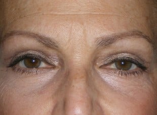 Patient 133 - After View 