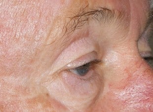 Patient 138 - Before View 