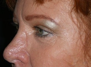 Patient 16 - After View 