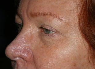 Patient 16 - Before View 