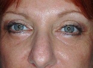 Patient 21 - After View 