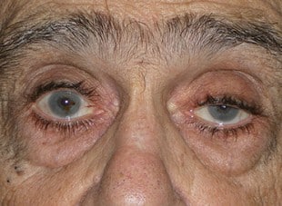 Patient 27 - Before View 