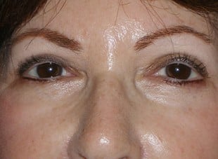 Patient 50 - After View 