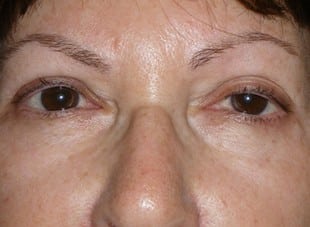 Patient 50 - Before View 