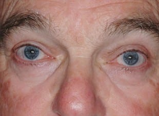 Patient 59 - After View 