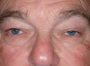 Patient 59 - Before View 