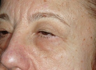 Patient 63 - Before View 