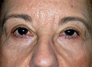 Patient 63 - After View 
