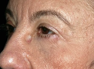 Patient 63 - After View 