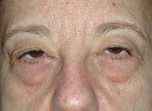 Patient 63 - Before View 