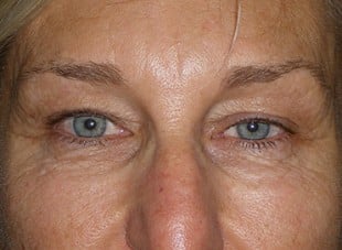 Patient 67 - Before View 