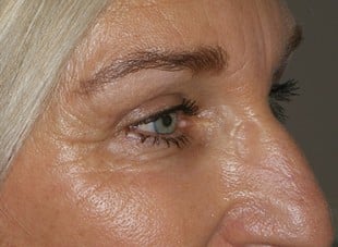 Patient 67 - After View 