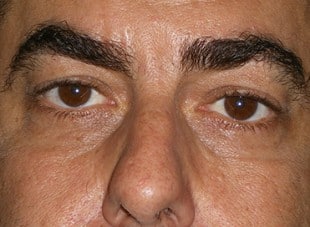 Patient 17 - After View 