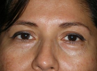 Patient 28 - Before View 