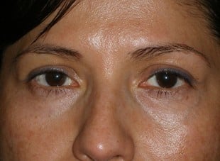 Patient 28 - After View 