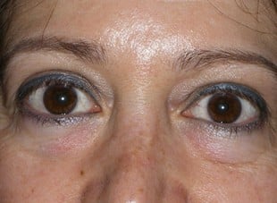 Patient 40 - After View 