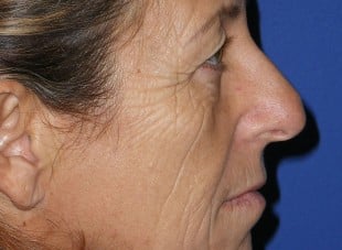 Patient 3 - Before View 