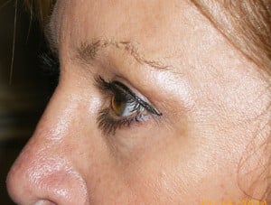 Patient 130 - After View 