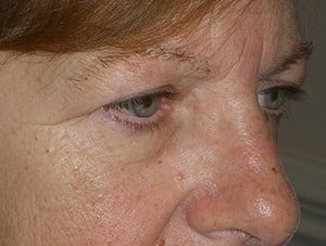 Patient 120 - Before View 