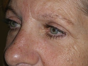 Patient 120 - After View 